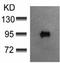 Proto-oncogene vav antibody, TA324236, Origene, Western Blot image 