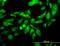 Kinesin Family Member C1 antibody, orb94664, Biorbyt, Immunocytochemistry image 