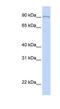 Amine Oxidase Copper Containing 2 antibody, NBP1-62443, Novus Biologicals, Western Blot image 