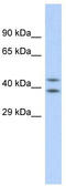 Dihydroorotate Dehydrogenase (Quinone) antibody, TA346287, Origene, Western Blot image 