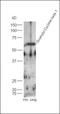 Polypeptide N-Acetylgalactosaminyltransferase 6 antibody, orb183833, Biorbyt, Western Blot image 