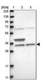 Zinc Finger AN1-Type Containing 1 antibody, PA5-54782, Invitrogen Antibodies, Western Blot image 