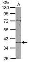 RNA 3 -terminal phosphate cyclase-like protein antibody, GTX104252, GeneTex, Western Blot image 