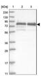 DDB1 And CUL4 Associated Factor 8 antibody, NBP1-92582, Novus Biologicals, Western Blot image 