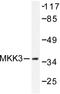 Mitogen-Activated Protein Kinase Kinase 3 antibody, AP06222PU-N, Origene, Western Blot image 
