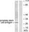 Prostate Stem Cell Antigen antibody, LS-B11345, Lifespan Biosciences, Western Blot image 