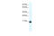 Pod-1 antibody, 27-860, ProSci, Enzyme Linked Immunosorbent Assay image 