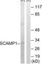 Secretory Carrier Membrane Protein 1 antibody, LS-C120354, Lifespan Biosciences, Western Blot image 