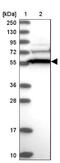 Coiled-Coil Domain Containing 91 antibody, NBP1-84084, Novus Biologicals, Western Blot image 