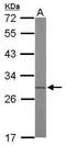 ETHE1 Persulfide Dioxygenase antibody, GTX115707, GeneTex, Western Blot image 