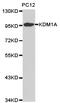 Lysine Demethylase 1A antibody, TA326956, Origene, Western Blot image 