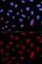 Troponin C1, Slow Skeletal And Cardiac Type antibody, GTX33061, GeneTex, Immunofluorescence image 