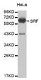 Serum Response Factor antibody, MBS125761, MyBioSource, Western Blot image 