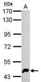 Homocysteine Inducible ER Protein With Ubiquitin Like Domain 1 antibody, GTX112261, GeneTex, Western Blot image 