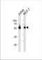 Zinc Finger And SCAN Domain Containing 32 antibody, TA325152, Origene, Western Blot image 