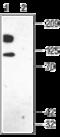 Potassium Voltage-Gated Channel Subfamily B Member 1 antibody, GTX16640, GeneTex, Western Blot image 