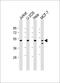 Proteasome 26S Subunit, ATPase 2 antibody, M09306, Boster Biological Technology, Western Blot image 