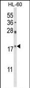 PIN1 antibody, PA5-35372, Invitrogen Antibodies, Western Blot image 