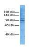 Leucine Rich Repeat Containing 8 VRAC Subunit A antibody, GTX46069, GeneTex, Western Blot image 