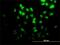 Diphthamide Biosynthesis 2 antibody, H00001802-M02, Novus Biologicals, Immunocytochemistry image 