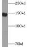CD163 antibody, FNab09771, FineTest, Western Blot image 