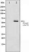 SRC Proto-Oncogene, Non-Receptor Tyrosine Kinase antibody, orb106050, Biorbyt, Western Blot image 