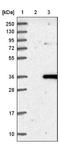 Rogdi Atypical Leucine Zipper antibody, NBP1-82123, Novus Biologicals, Western Blot image 
