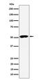 Protein Phosphatase 2 Regulatory Subunit B'Epsilon antibody, M07588, Boster Biological Technology, Western Blot image 