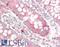 Scribble antibody, LS-B13413, Lifespan Biosciences, Immunohistochemistry paraffin image 