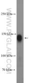Sca2 antibody, 21776-1-AP, Proteintech Group, Western Blot image 