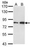 CTD Phosphatase Subunit 1 antibody, GTX104649, GeneTex, Western Blot image 