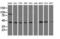 Aldehyde Dehydrogenase 1 Family Member L1 antibody, LS-C115730, Lifespan Biosciences, Western Blot image 