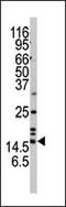 Synuclein Alpha antibody, AP13472PU-N, Origene, Western Blot image 