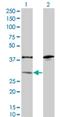 Sulfotransferase 1A1 antibody, H00006817-M01A, Novus Biologicals, Western Blot image 