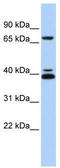 GATA Binding Protein 6 antibody, TA329425, Origene, Western Blot image 