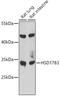 Hydroxysteroid 17-Beta Dehydrogenase 3 antibody, 23-107, ProSci, Western Blot image 