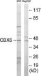 Chromobox 6 antibody, EKC1662, Boster Biological Technology, Western Blot image 