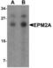 Laforin antibody, LS-B8862, Lifespan Biosciences, Western Blot image 