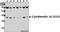 KRT18 antibody, A01357S33, Boster Biological Technology, Western Blot image 