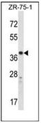 Cysteinyl Leukotriene Receptor 1 antibody, AP51175PU-N, Origene, Western Blot image 