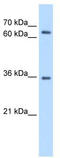 Protein Phosphatase 2 Regulatory Subunit B''Beta antibody, TA346469, Origene, Western Blot image 