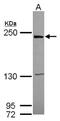 Leucine Rich Repeat Kinase 1 antibody, NBP2-17173, Novus Biologicals, Western Blot image 