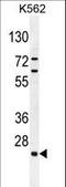 Chromosome 15 Open Reading Frame 41 antibody, LS-C167932, Lifespan Biosciences, Western Blot image 