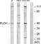 Glycerol-3-Phosphate Acyltransferase 3 antibody, TA315936, Origene, Western Blot image 