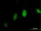 FA Complementation Group L antibody, H00055120-B01P, Novus Biologicals, Immunofluorescence image 