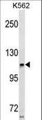 USH1C antibody, LS-C157025, Lifespan Biosciences, Western Blot image 