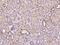 Succinate-CoA Ligase GDP-Forming Beta Subunit antibody, 204220-T08, Sino Biological, Immunohistochemistry paraffin image 