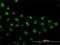 Zic Family Member 4 antibody, H00084107-M01, Novus Biologicals, Immunocytochemistry image 