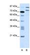 Zinc Finger Protein 709 antibody, NBP1-80164, Novus Biologicals, Western Blot image 