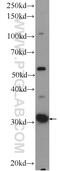 Chromosome 11 Open Reading Frame 54 antibody, 23251-1-AP, Proteintech Group, Western Blot image 